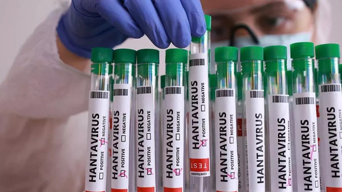 Around 30 people under observation in Canada over suspected hantavirus exposure