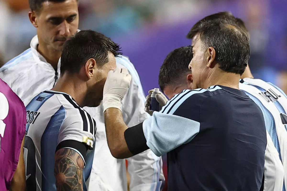 Messi suffers facial injury in Argentina’s win over Switzerland