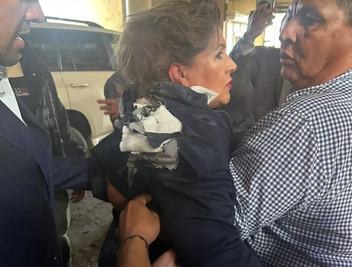 Honduran opposition lawmaker struck by explosive device at Congress PHOTO/VIDEO