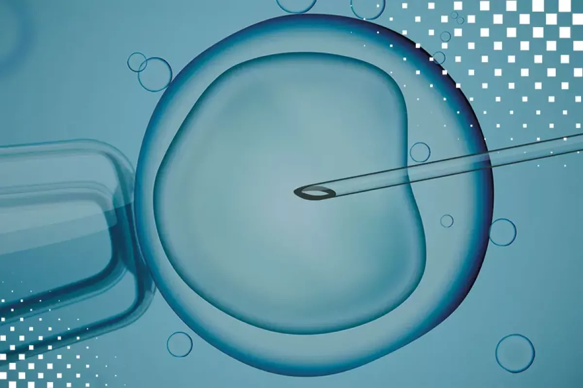 Years later, DNA tests uncover suspected IVF donor mix-ups in northern Cyprus