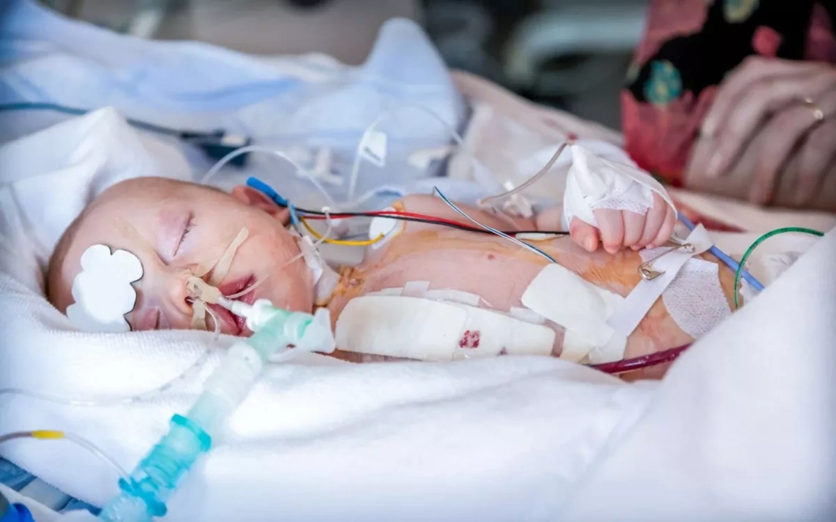 Broken system: infant mortality as a symbol of France’s crisis Analysis by Artem Kirpichenok