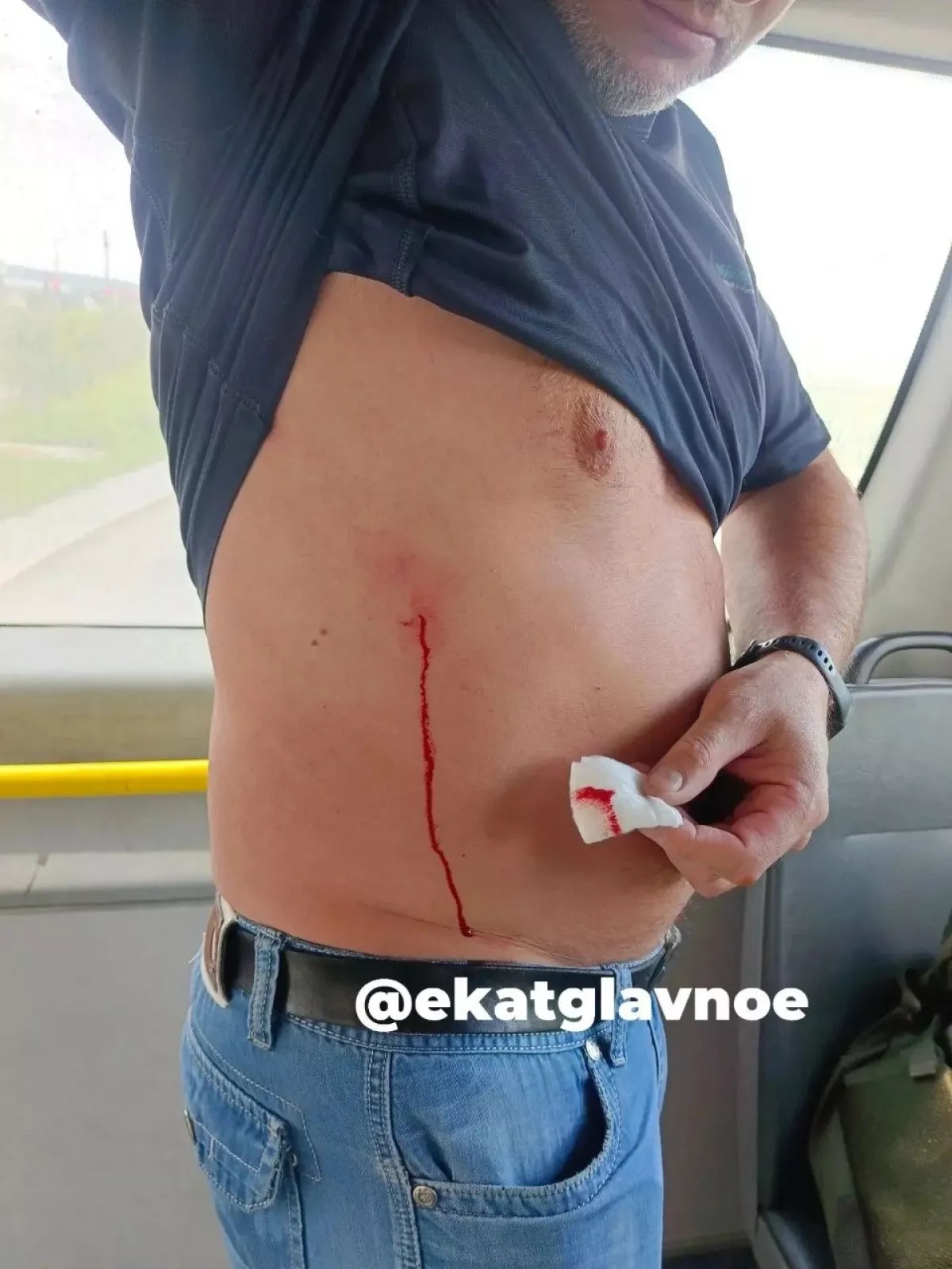 Passenger injured after gunfire targets buses in Russia’s Yekaterinburg PHOTO