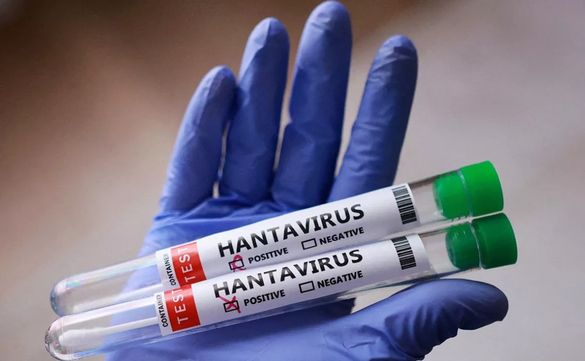 Hantavirus case sparks strict quarantine measures in France