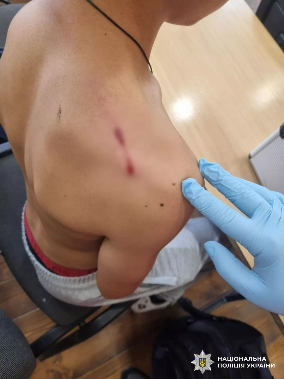 Student opens fire in Ukrainian school, injuring classmate Photo