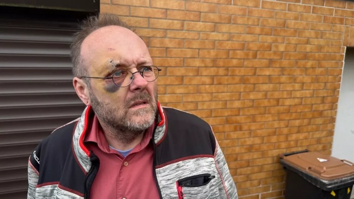 Ex-AfD politician attacked outside home in Germany PHOTO