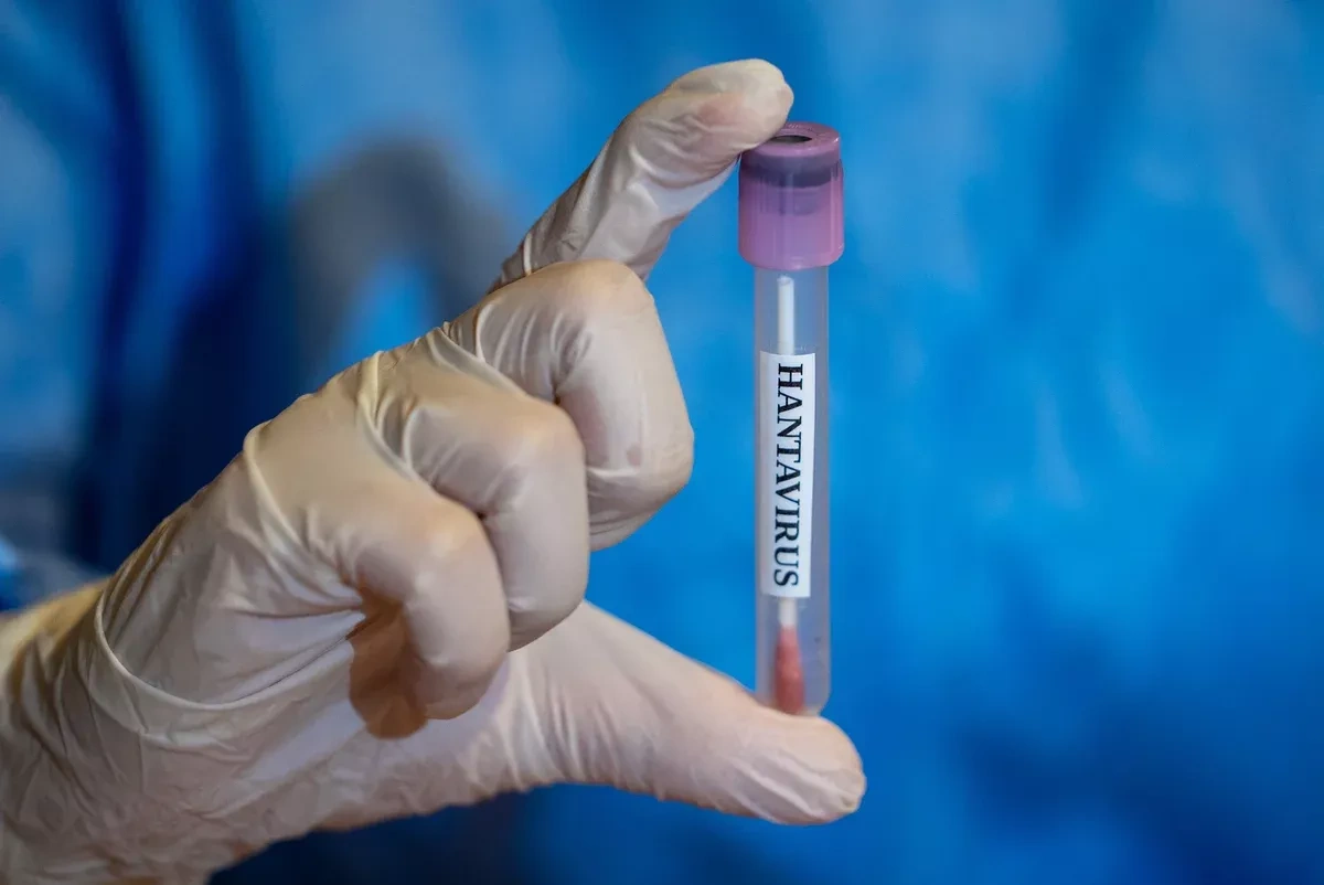 Kazakhstan says Hantavirus not circulating in country