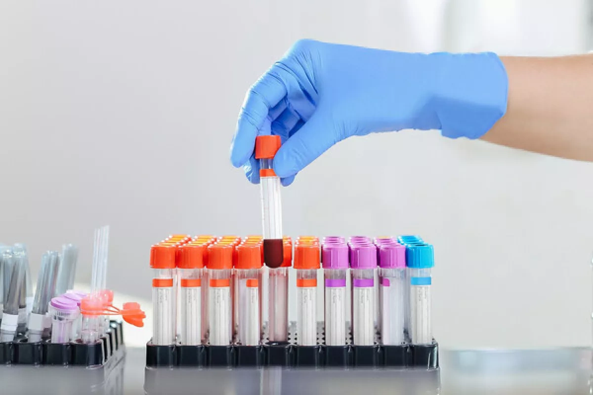 Mirror: Australian lab loses hantavirus samples in mysterious 2021 incident