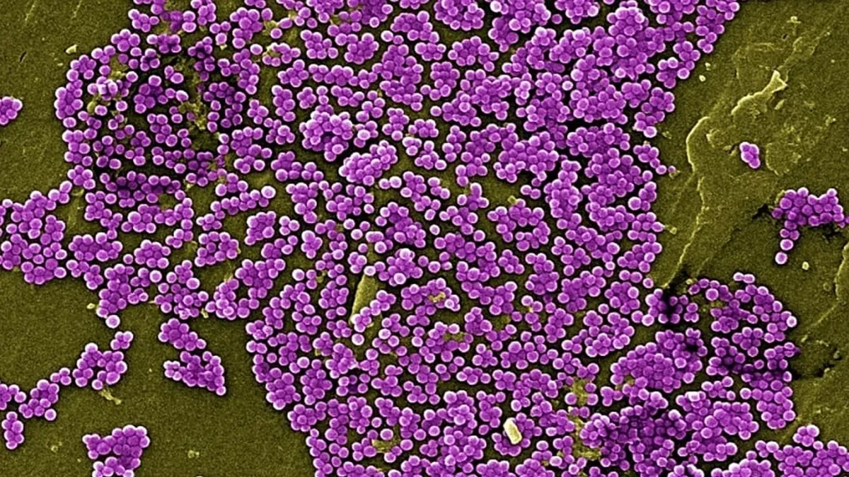 Scientists discover mechanism that breaks down bacterial biofilms