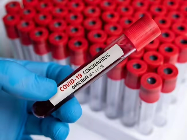 WHO tracks global COVID-19 deaths, identifies key impacted countries