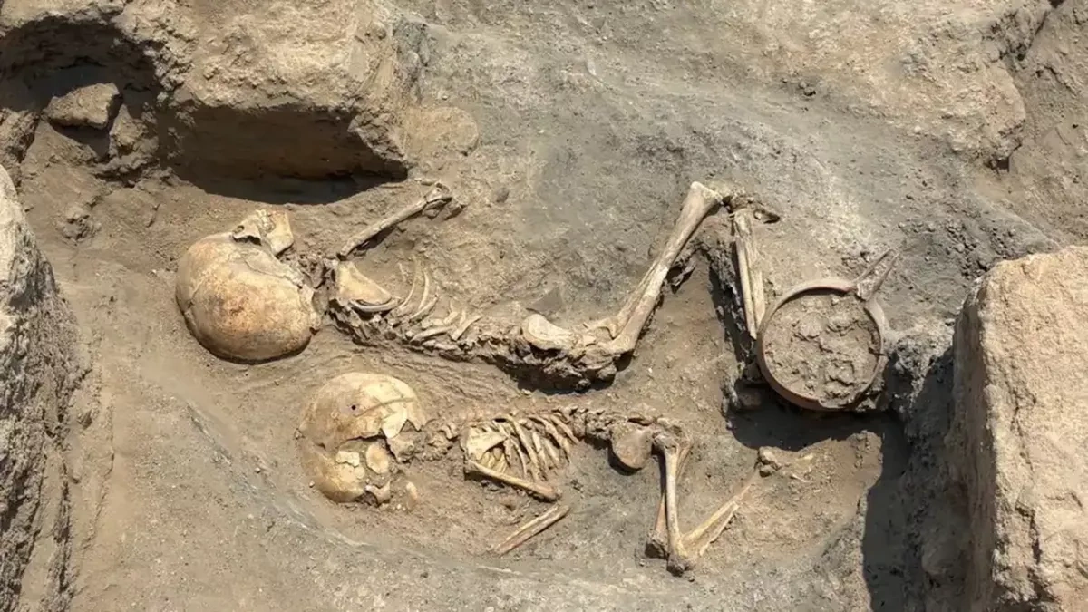 Discovered fossilized bones serve as oldest evidence of surgery in Central Asia