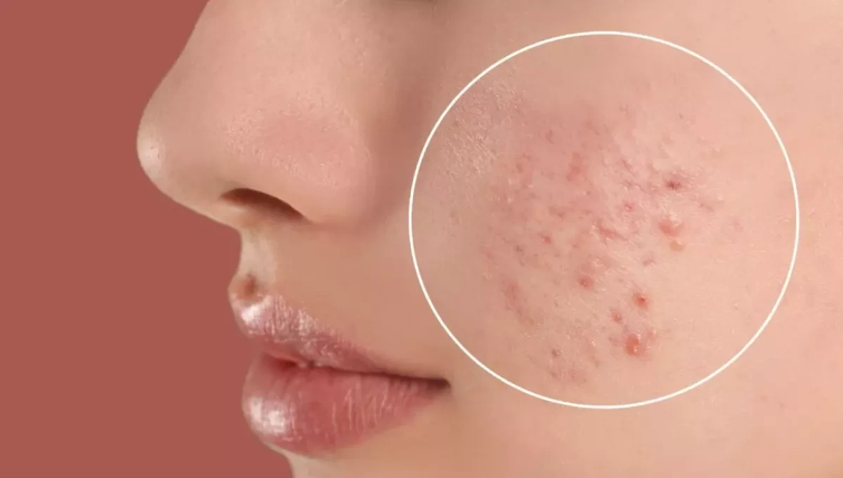 Chinese scientists advance new approach to treating inflammatory skin conditions