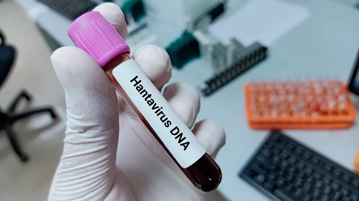 Three European countries receive first shipments of hantavirus treatment drug