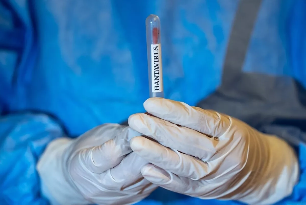 WHO: Dutch KLM flight attendant tests negative for Hantavirus